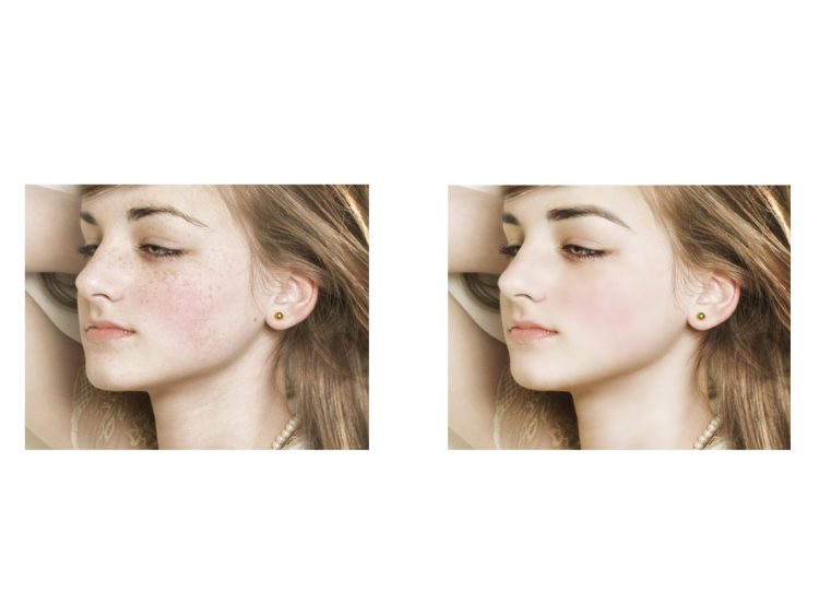 인물보정/ 몸매보정/ 우정사진/ 커플사진/ 웨딩사진/ 보정해드립니다-이미지